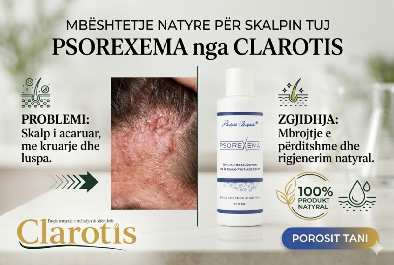Psorexema shampo nga CLAROTIS, shampo ekzeme, shampo psoriasis, shampo natyrale flokesh, shampo per skalp, shampo antiinflamator, shampo kundra kruarjes, shampo per zbokth, shampo herbal, shampo sensitive